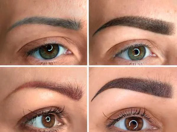 Eyebrows neutralization